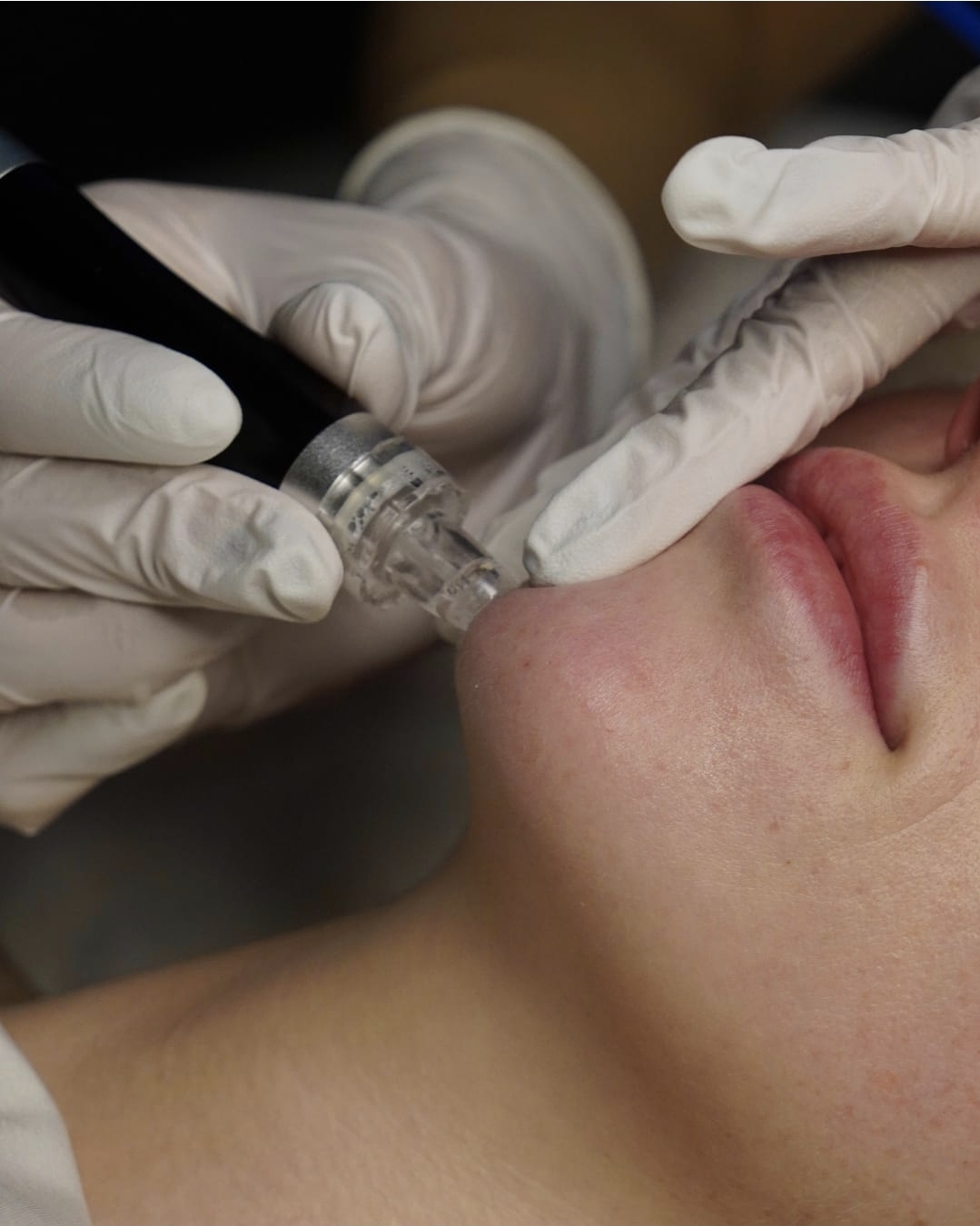 Facial